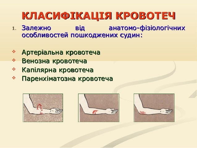 Методическое указание по теме Кровотеча та крововтрата Методическое указание по теме Кровотеча та крововтрата